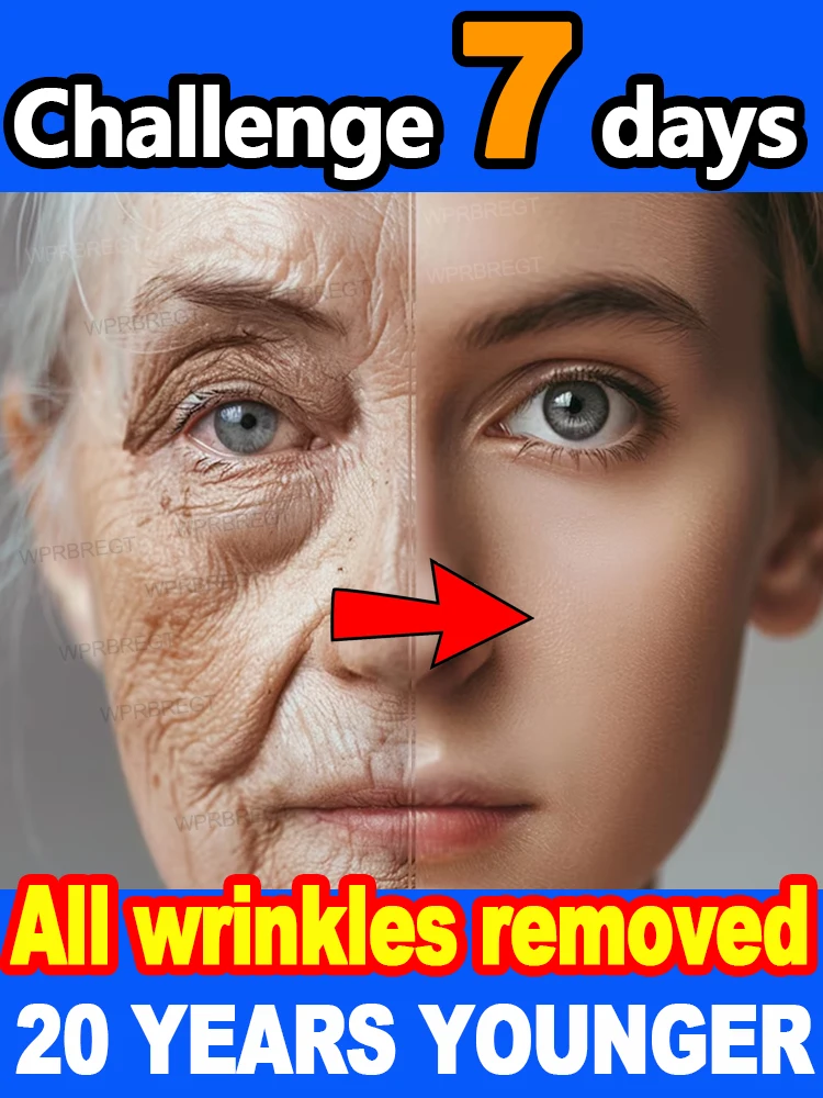 

Wrinkles disappear