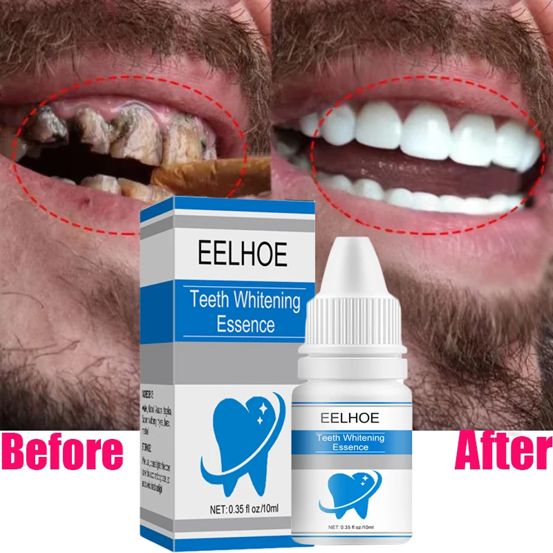 

Cleaning Tooth Whitening Serum Effective Remove Plaque Serum Yellow Teeth Tooth Stains Removal Serum Fresh Breath Toothpaste