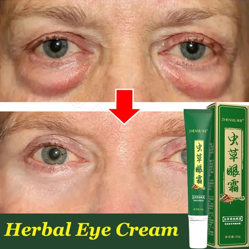 Instant Eye Bag Removal Cream Collagen Removal Wrinkles Lifting Fade Fine Lines Moisturizing Brightening Anti Puffiness Eye Care