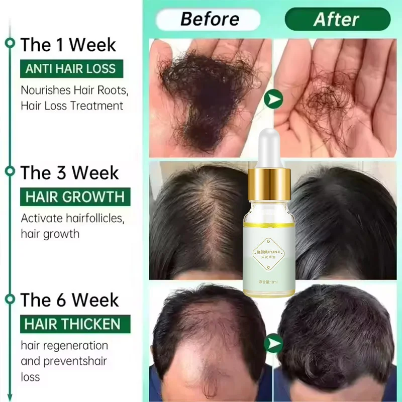 

Hair Addition Dense Hair Dense Hair Care Scalp Nutrient Solution Care Hair Growth Solution