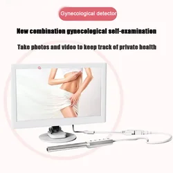 Home Intelligent Visual High Definition Colposcope Endoscope Cervicoscope Gynecological Test Instrument Self-Examination