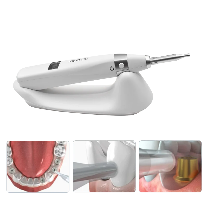 New Arrival Dental Implant stability meter Fast Check Dentistry Clinic Portable Equipment Insightful Analysis