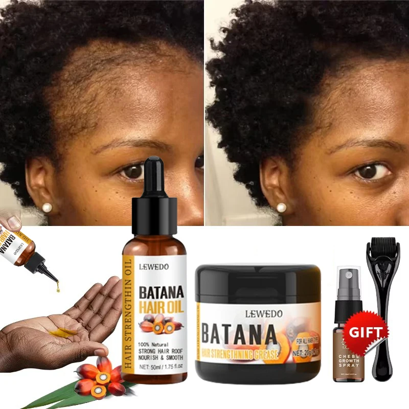 Fast Hair Growth Set Batana Oil Traction Alopecia Hair Mask Anti Break Loss Hair Growth Oil Baldness Treatment Batana Essential