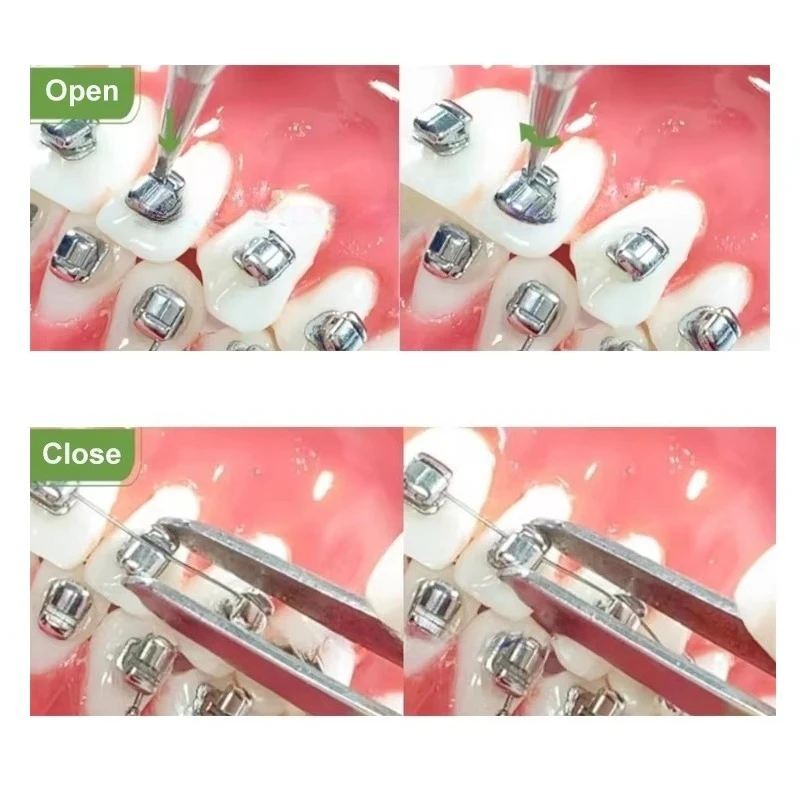 20Pcs/Box Dental Orthodontic Metal Self-ligating Brackets Braces Monoblock Roth MBT 0.022 Hooks345 With Tool Dentistry Materials