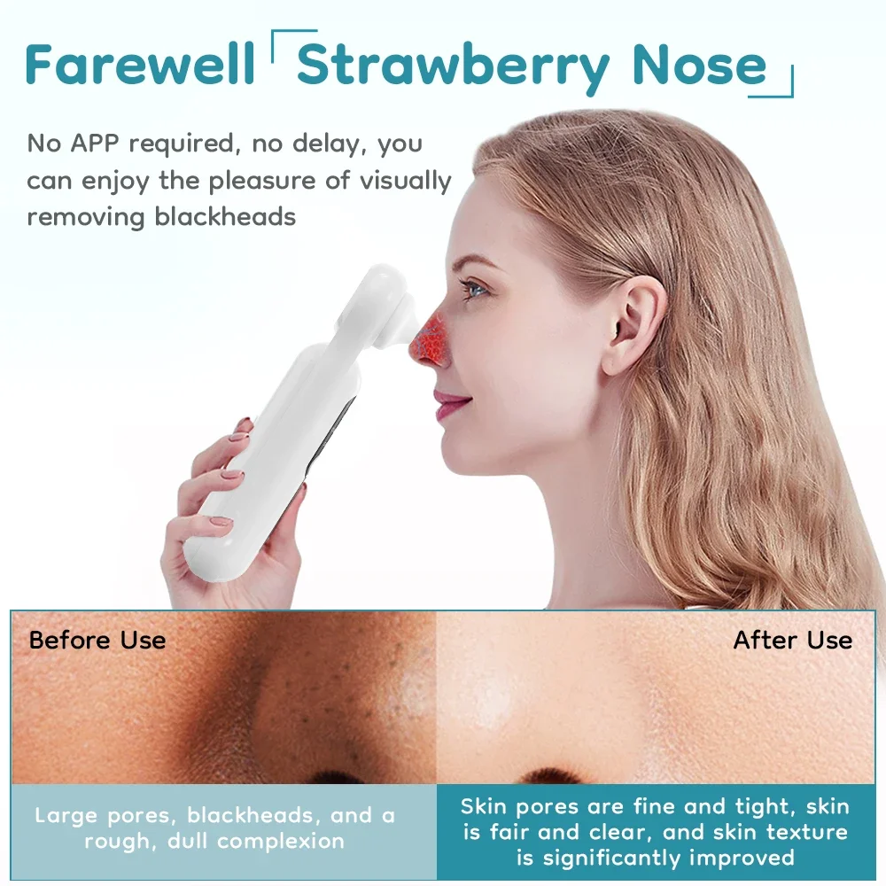 Professionele mee-eterverwijderaar met 3 modi Zacht comfort Sterke zuigkracht Neusreiniging 5x vergroting LED-licht Type-C Opladen