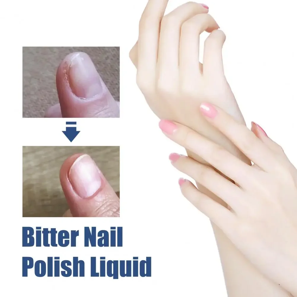 

Sdatter Stopping Nail Biting Polish Non-irritating Effective Quit Sucking Thumbs Health Care Bitter Taste Nail Biting Treatment