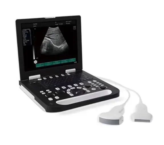 Full digital laptop ultrasound scanner SS-10