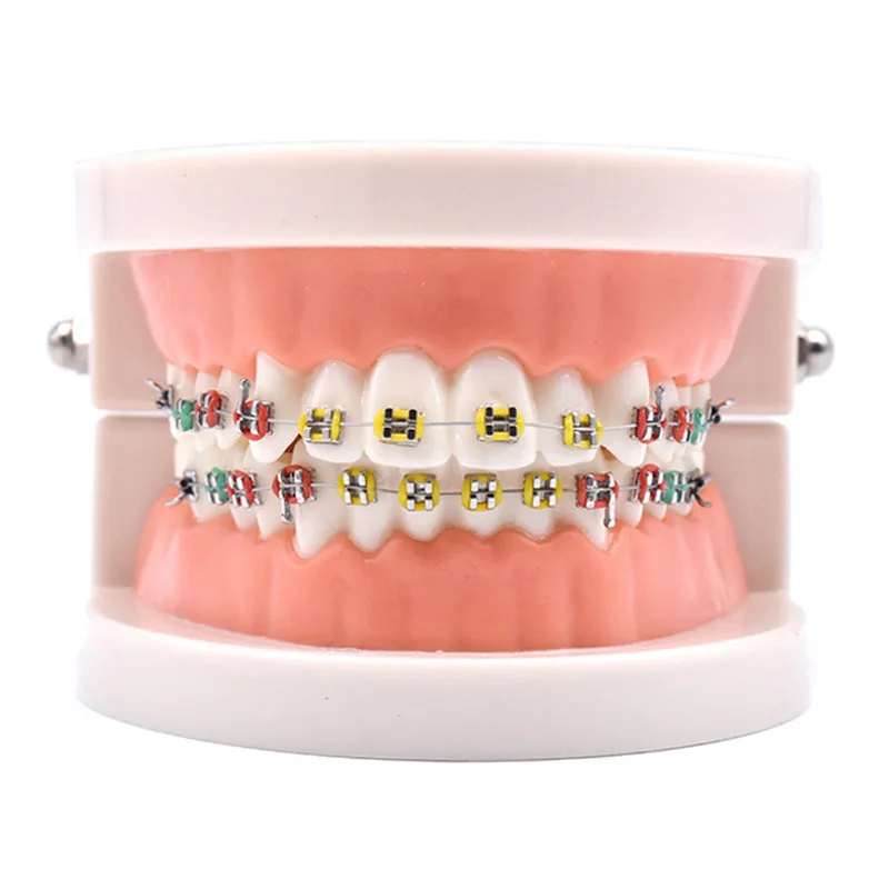 Dental Materials Orthodontic Correction Model  Standard Metal Oral Dental Bracket Model Dental Tools Dentist Lab Denture Model