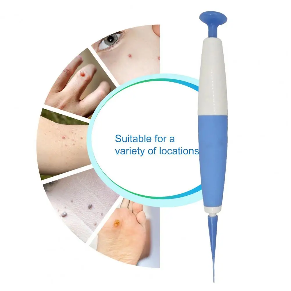 مجموعة أقلام متطورة لإزالة العلامات الجلدية للرجال والنساء ، سهلة الاستخدام ، مجموعة مزيل الثآليل ، آمنة ، فعالة ، صغيرة لسرعة