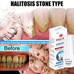 Dental Calculus Remover Spray Teeth Whitening Serum Remove Plaque Stains Halitosis Cleaning Oral Hygiene Fresh Bad Breath Care