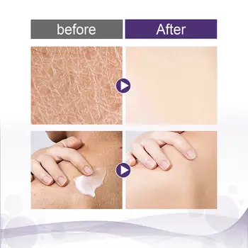 8 best sales جلد الدجاج - №4