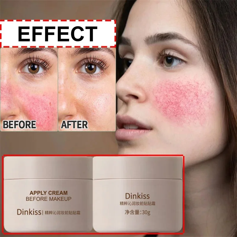 High Quality Facial Redness Repair Cream Rosacea Treat Sensitive Skin Dryness Moisturizer Sooth Lotion Korean Cosmetics