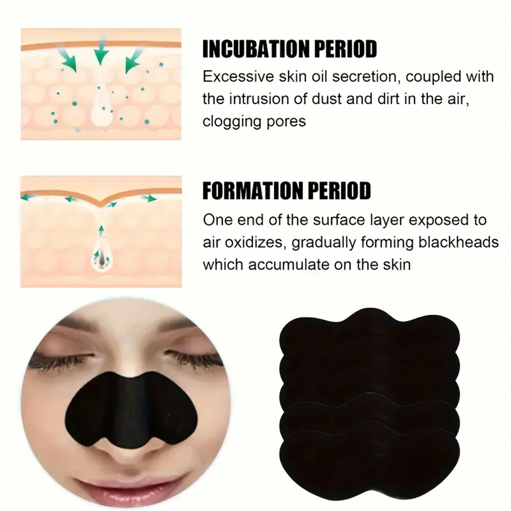 Blackhead Removal Nose Patch Unisex Deep Cleansing Nose Strips for Acne & Blackhead Removal Shrink Pore Nose Black Head Stickers Saaae05ac5b6b4c208da0255d4afcbd5cz
