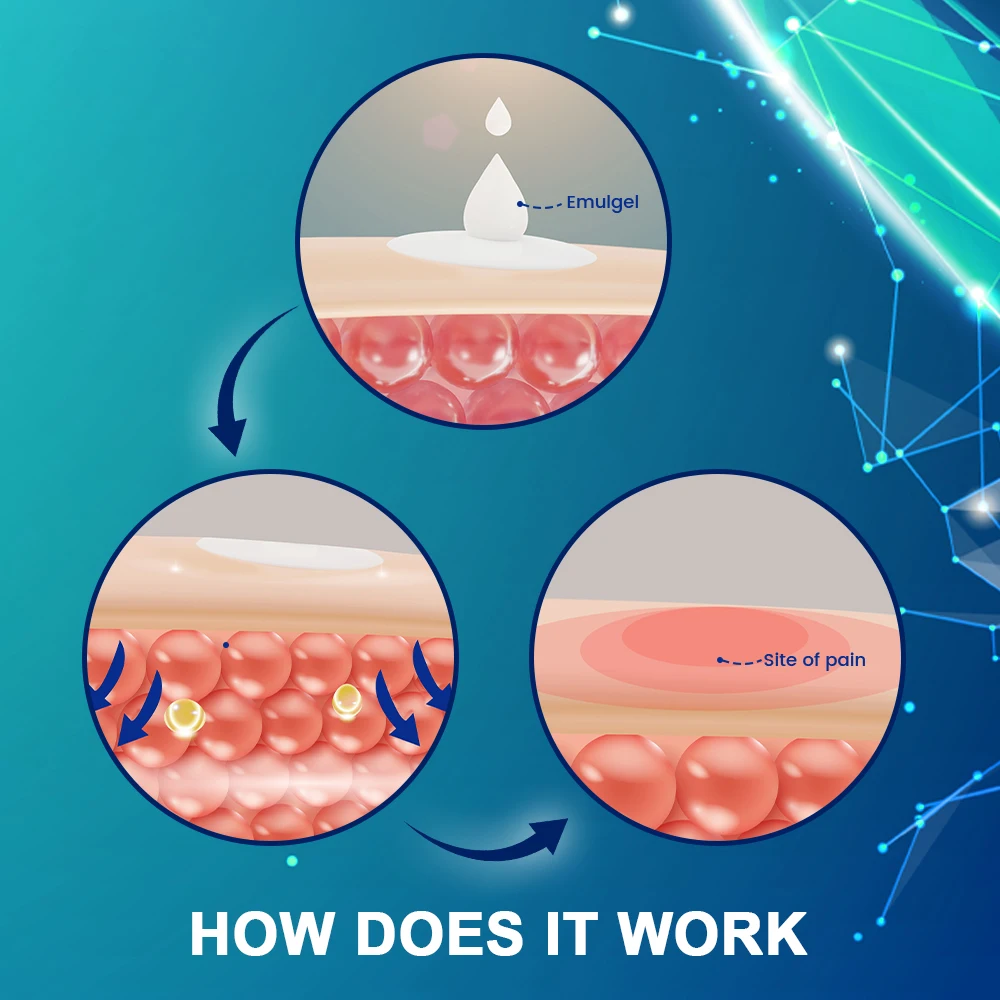 1/5/10 шт. Sumifun синовит мениск, обезболивающая мазь, крем для облегчения боли в коленях, массаж боли в мышцах суставов, медицинский пластырь 1/5/10 шт. Sumifun синовит мениск, обезболивающая мазь, крем для облегчения боли в коленях, массаж боли в мышцах суставов, медицинский пластырь