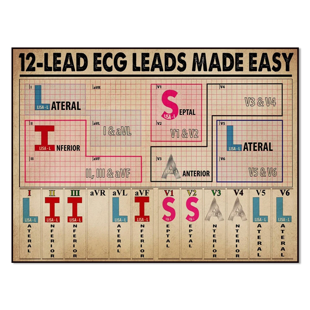 12 Lead EKG Leads Made Easy Poster, Cardiologist Guide Plaque Hospital Office Clinic Decor Poster