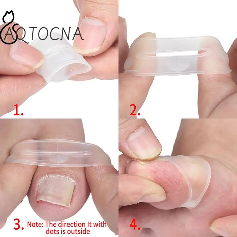 Toenail Correction Silicone Ingrown Tool Invisible Ingrown Toe Nail Treatment Elastic Straightening Clip Brace Pedicure Tool