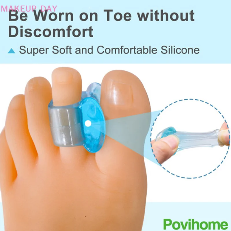 Mathiateur de gel de silicone souple bleu, outil de soin des pieds, entretoises d'hallux valgus et d'oignon, 2 pièces