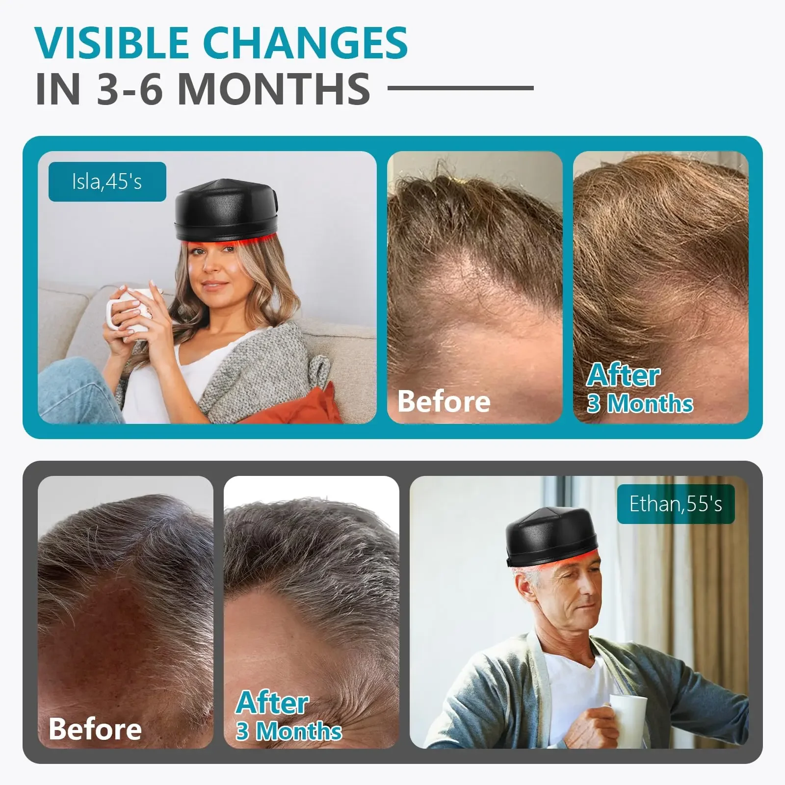 Wireless Hair Growth Laser Cap Against Hair Loss 660nm&850nm Red Light Therapy Cap for Seborrheic Alopecia Damaged Hair 3000mAH