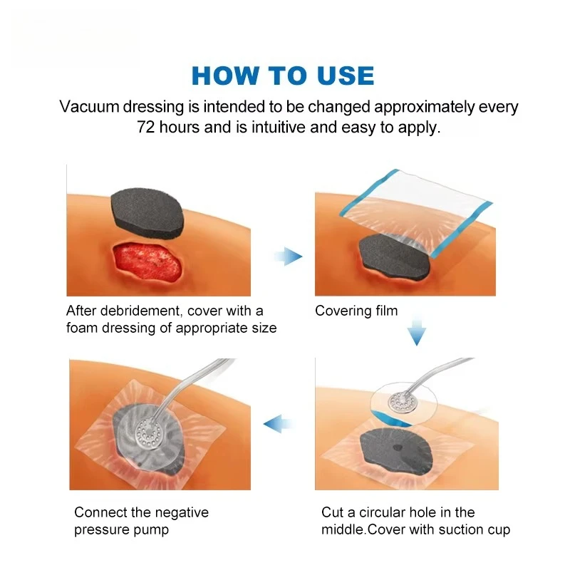 Adhesive Customized Size Medical Waterproof Breathable Transparent Film NPWT Dressing Three Layer Film for NPWT VAC Therapy