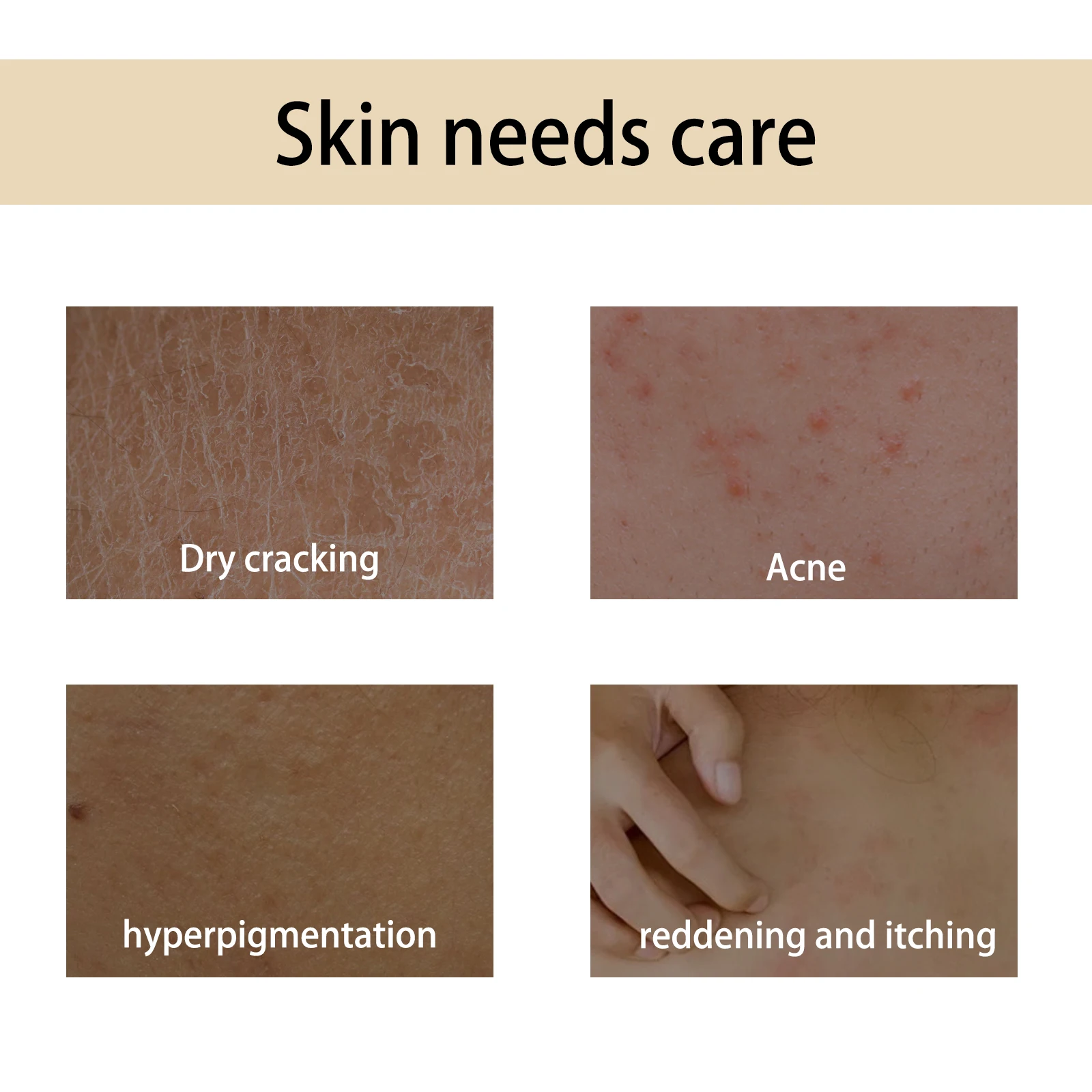 OceAura Handcrafted Body Oil Body Massage Moisturizing Firming And Tender Skin Care Essential Oil