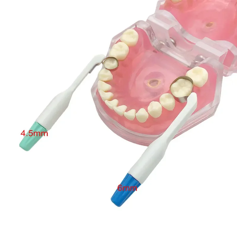 2Pcs Dental Sectional Matrix Ring System Roll Type Dental Matrix Tape Band Dentistry Materials