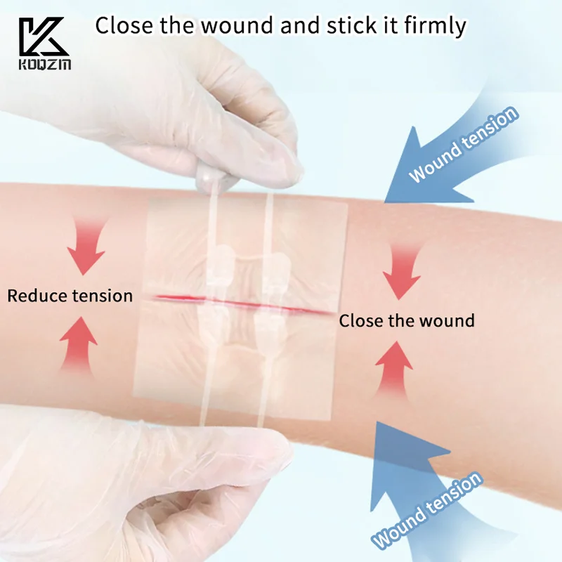 

2Pcs Zipper Tie Wound Closure Patch Elastic Strap Fast Suture Hemostatic Patch Skin Care Disinfect Band-Aid Outdoor