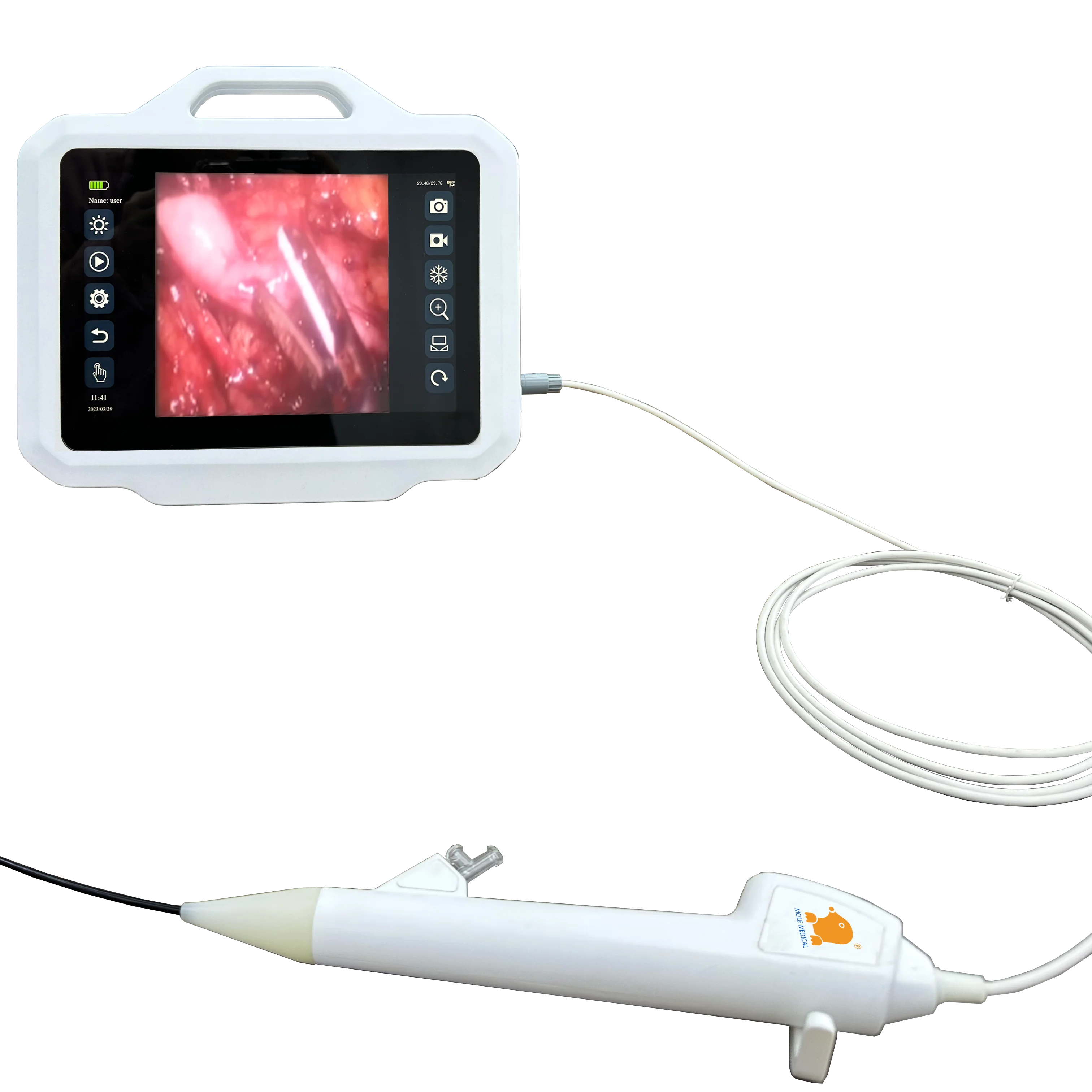 

Mole Medical 2024 New Disposable Flexible Ureteroscope Portable Hd Endoscope Image Processor