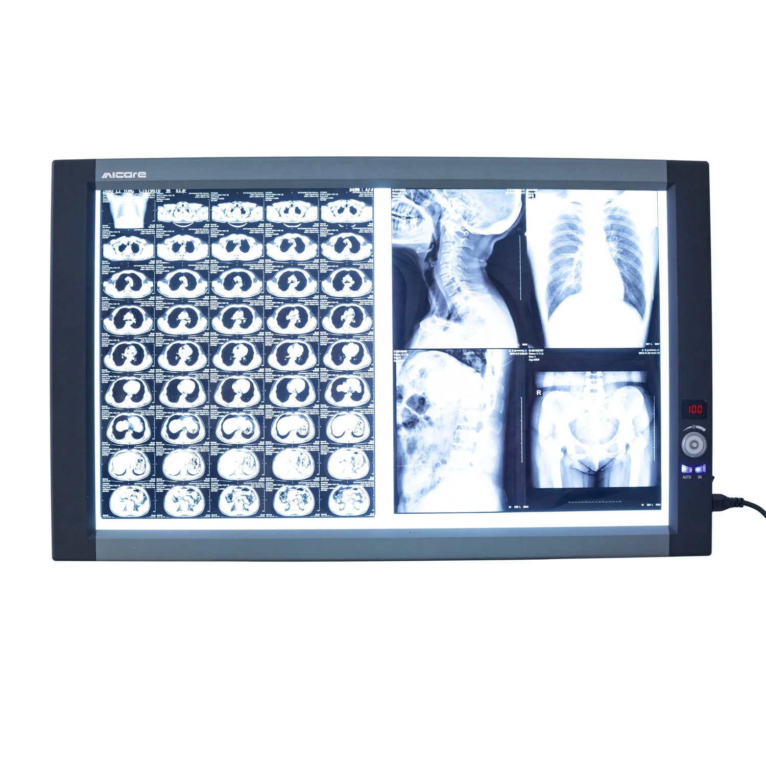 

Professional medical equipment Negatoscope LED X-Ray Film Viewer Double Screen ZG-2C