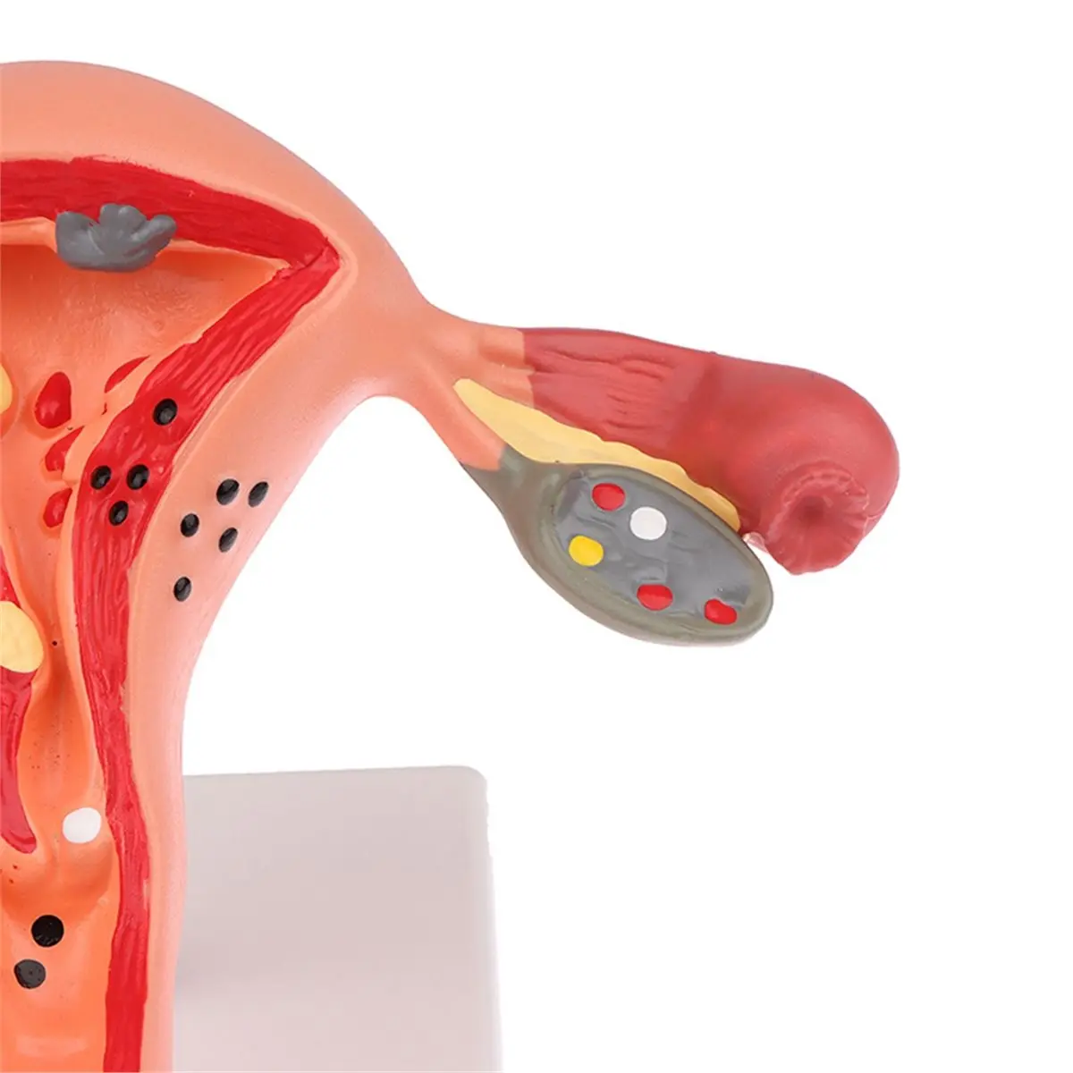 (A02R] Female Uterine Model, Anatomy of Reproductive Organ Structure, Human Teaching Pathology, Ovarian Hospital, School Use