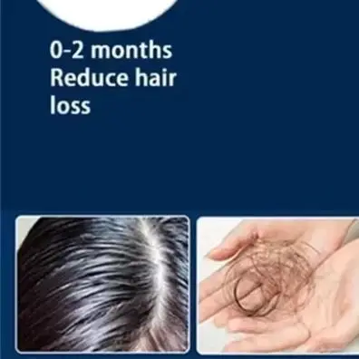 

Лазерная шапка для роста волос 96 лазеров, 650 нм, LLLT, терапия красным светом, для контроля жирности кожи головы, предотвращения выпадения и истончения волос