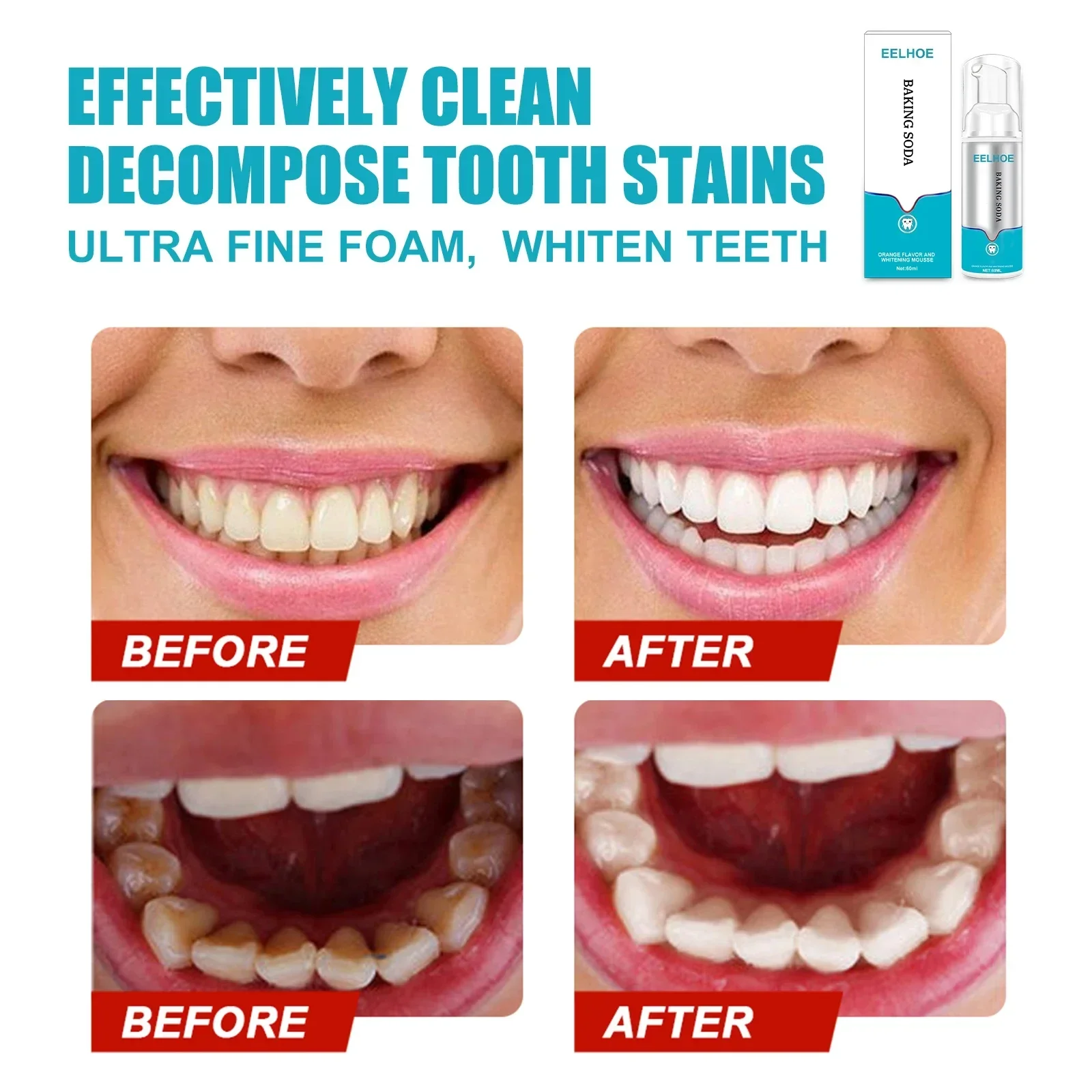 2-3pcsPress-type Tooth Mousse Removes Tobacco Stains Removes Yellow Teeth Freshens Breath, and Effectively Brightens The Mouth