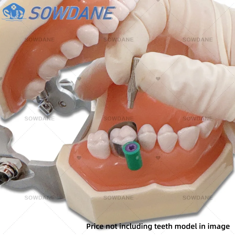 50pc/Box Dental Matrix Bands Steel Matrix Double-Side Contoured Anatomically Shaped Matrix Bands for Dentistry with Tool