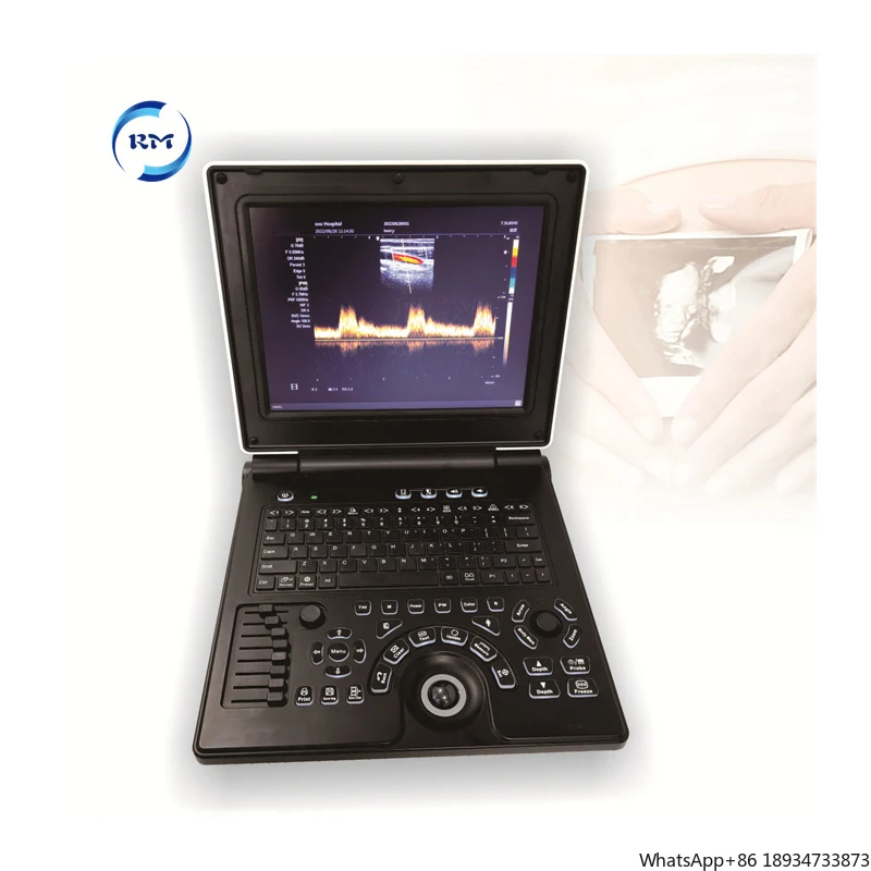 Medical Ultrasound Instruments for hospital clinic with 12 inch Color Screen Doppler Ultrasound machine