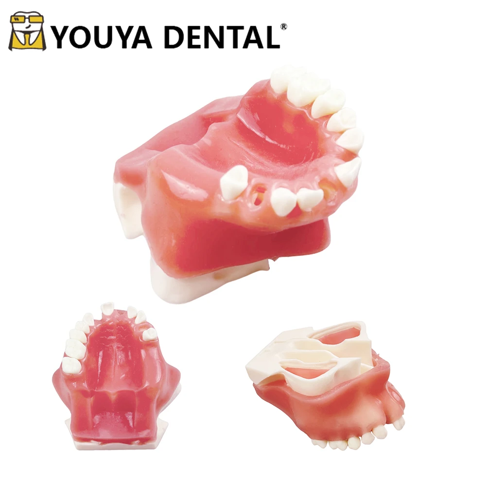 

Модель зубов верхнечелюстной пазухи, зубной имплантат, обучающая модель для студентов с мягкими деснами, базовые обучающие модели имплантата, инструменты