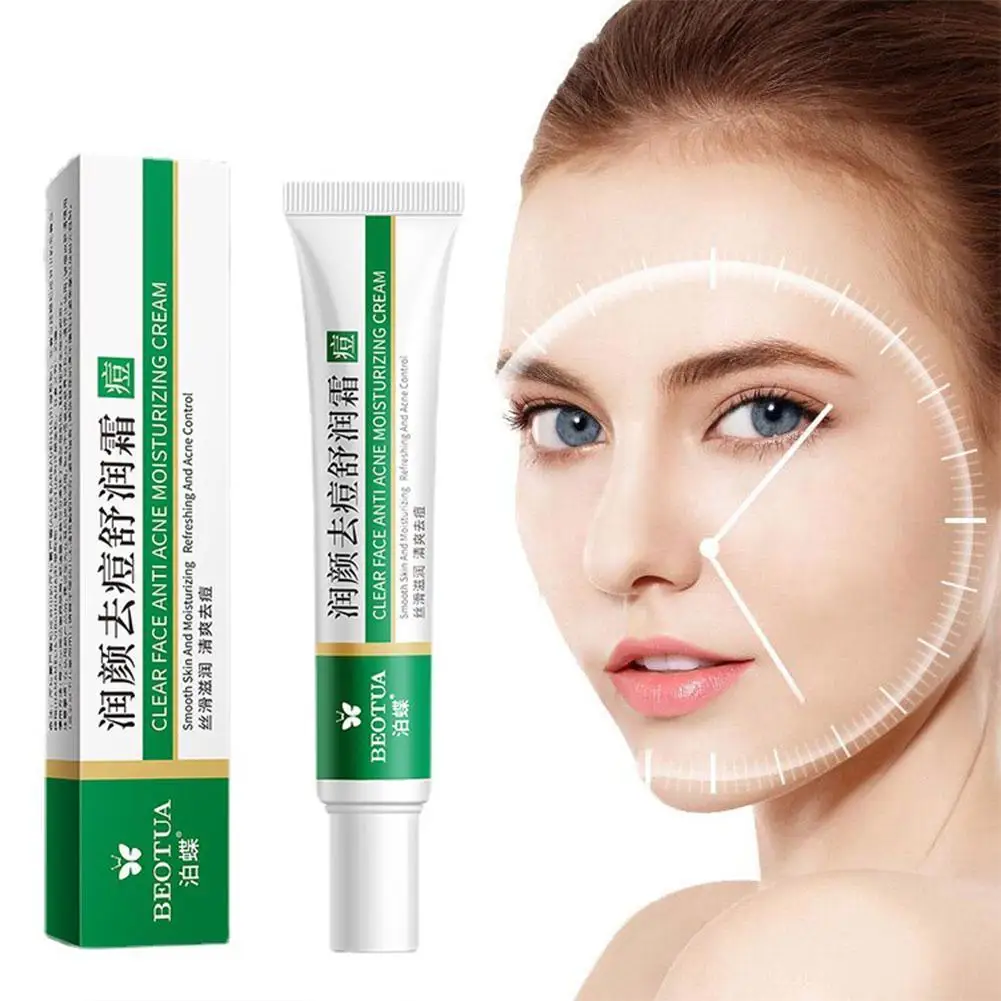 Herbal Anti Effective Acne Removal Cream Effective Acne Removal Cream Oil Control Whitening Moisturizing Face Gel Skin