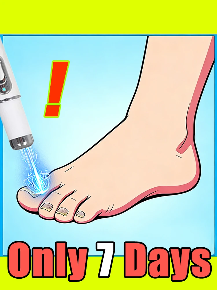 

new hot cleaning of champagne-colored nail laser penʜᴇʟᴘs ʏᴏᴜ sᴀʏ ɢᴏᴏᴅʙʏᴇ ᴛᴏ ᴏɴʏᴄʜᴏᴍʏᴄᴏsɪs. Tᴇ