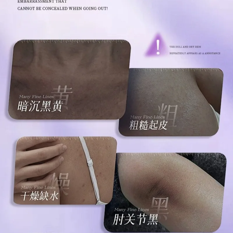377+877 Niacinamide Whitening Moisturizing Nourishing Body Lotion Reduces Dullness Improve Skin Clarity,Long-Lasting Smoothness