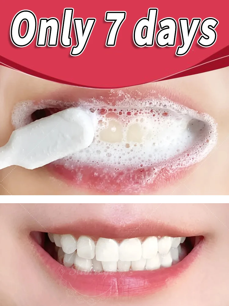 

Oral cleaning products, whitening, say goodbye to: tartar, stains