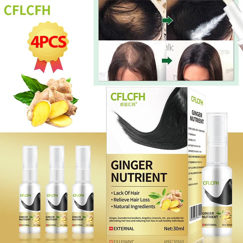 

Hair Growth Spray for Men Women Anti Hair Loss Treatment Care Ginger Ganoderma Lucidum Liquid Scalp Hair Regrowth Products