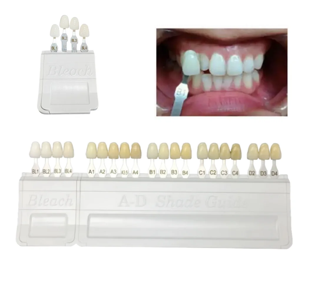 

1 комплект, съемная стоматологическая отбеленная направляющая A-D для оттенка, 4 цвета, таблица отбеливания зубов на основе отбеливания зубов Vita BL1/2/3/4