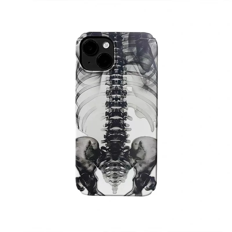 

Silver Black Skeleton Art Phone Case for IPHONE 17 Air 16E 15 PROMAX 14 Plus 13 12 MINI 11 PRO 16Plus XR XS Acrylic Phone Cover