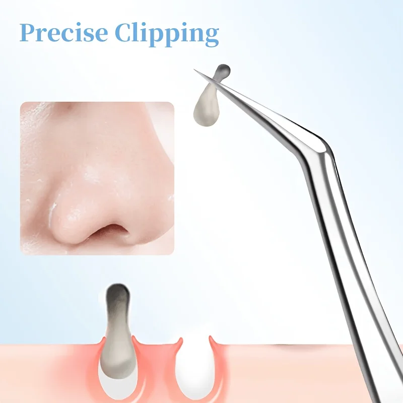 Thumbnail 3 - #28 Best Selling Skin Care Extractors
