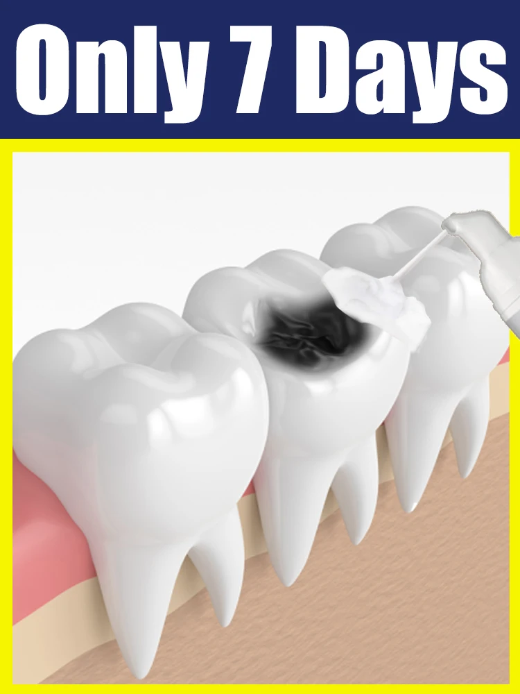 2nd ᵍᵉⁿᵉʳᵃᵗⁱᵒⁿ ᵘᵖᵍʳᵃᵈᵉᵈ ᵗᵒᵒᵗh ⸴ ʳᵉpᵃⁱʳ ᵗᵒᵒᵗh ʳᵒoᵗ ⸴ ᑫᵘⁱᶜᵏˡʸ