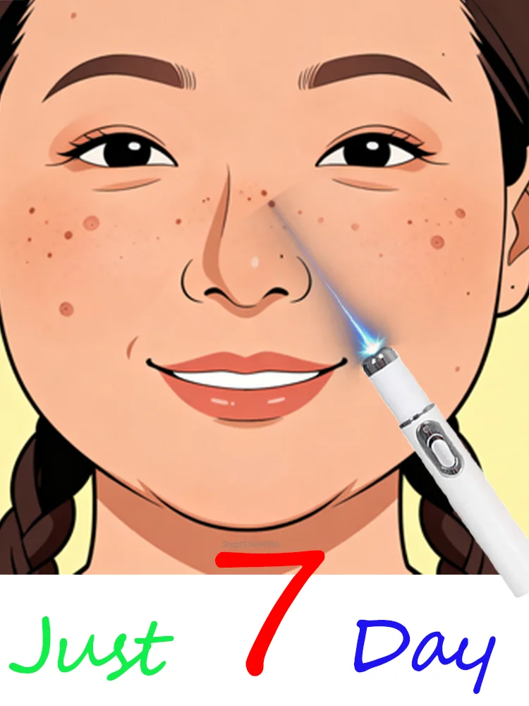 

Generation-3 Laser Says Goodbye To Warts In 7 Days