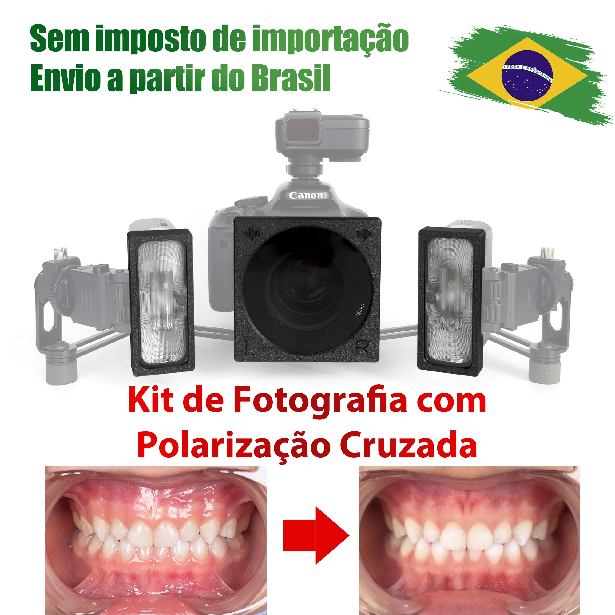 godox-mf12-flash-with-cross-polarization-filter-–-removes-reflections-and-glare-macro-dental-intraoral-and-aesthetic-photogra