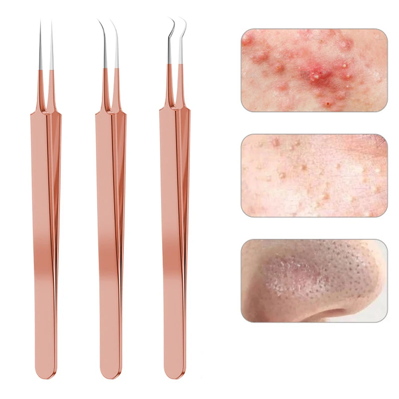 9/7/5 Stuks Acne Mee-Eter Verwijderingsnaalden Kits Roségoud Roestvrij Staal Black Spot Puistje Reinigingstool Gezicht Huidverzorging