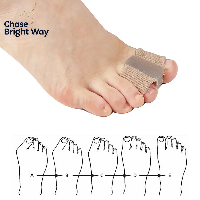 1/2Pcs Silicone Toe Spreader Separator Bunion Hallux Valgus Corrector Thumb Finger Correction Straightener Foot Care Tool