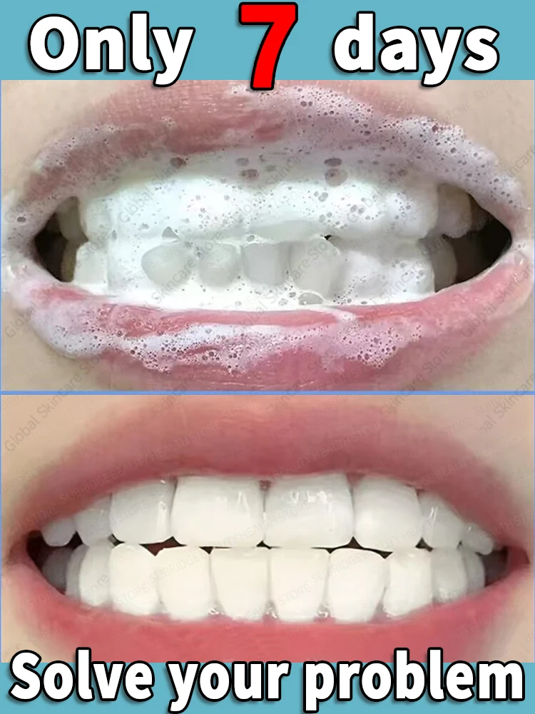 

99% of people will repurchase this dental mousse