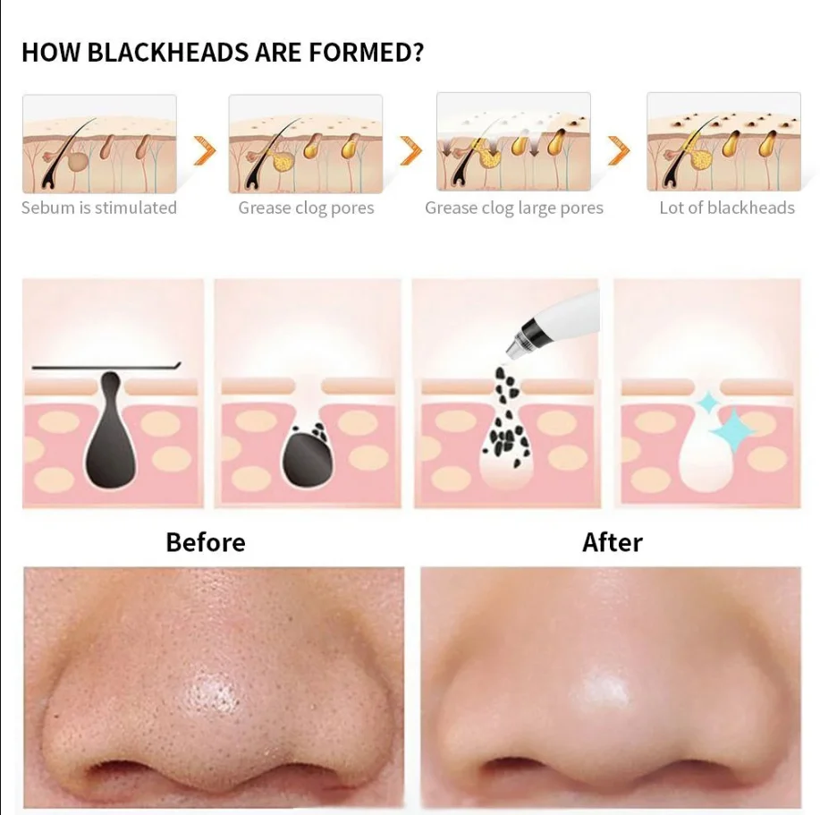 Facial Cleaning Blackhead Eliminators Nose Skin Care Cleaning Instrument Acne Remover USB Charge Face Tool Vacuum Suction
