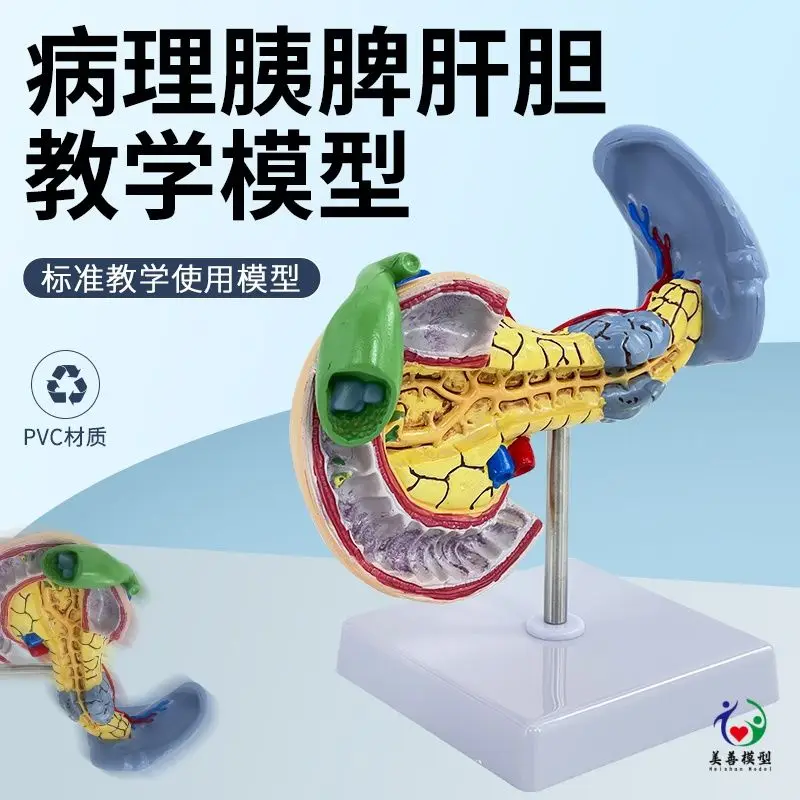 

Учебная имитация, поджелузные ягодицы, селезенка, гепатобилиар, модель дануда, образцы патологических поджелунков, поджелудочные зры, селезенка, H